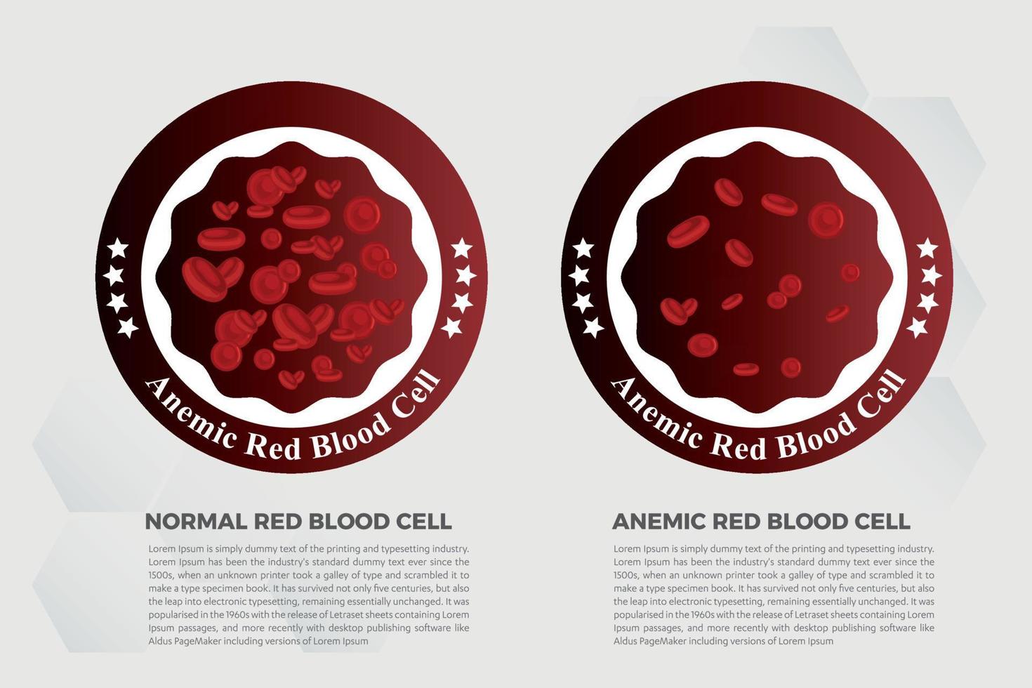 anemia hierro glóbulos rojos medical vector ilustración médica.