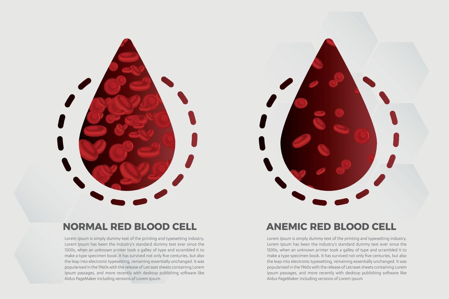 anemia hierro glóbulos rojos medical vector ilustración médica.