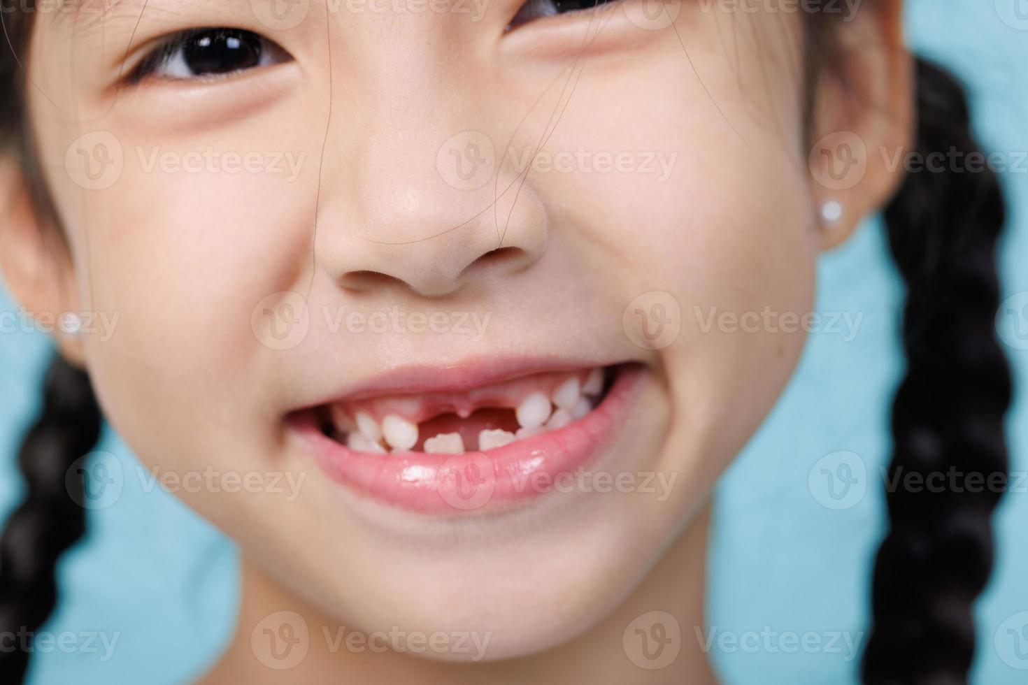 primer plano niño niña sonriendo con dientes sueltos, odontología y concepto de atención médica foto