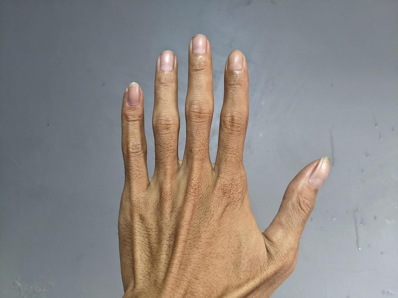 signaling with fingers or symbols photo