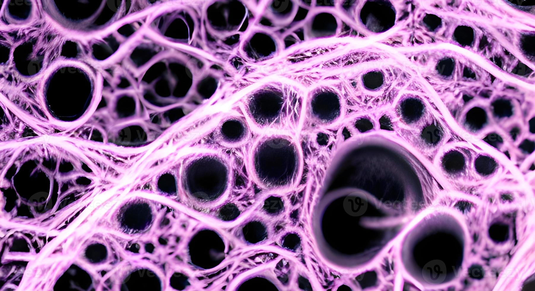 Bacteria and viruses on surface of skin, mucous membrane or intestine, model of MERS, HIV, flu, Escherichia coli, Salmonella, Klebsiella, Legionella, Mycobacterium tuberculosis, model of microbes photo