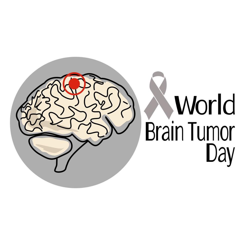 día mundial del tumor cerebral, representación esquemática del cerebro humano con el área afectada, concepto de pancarta o afiche vector