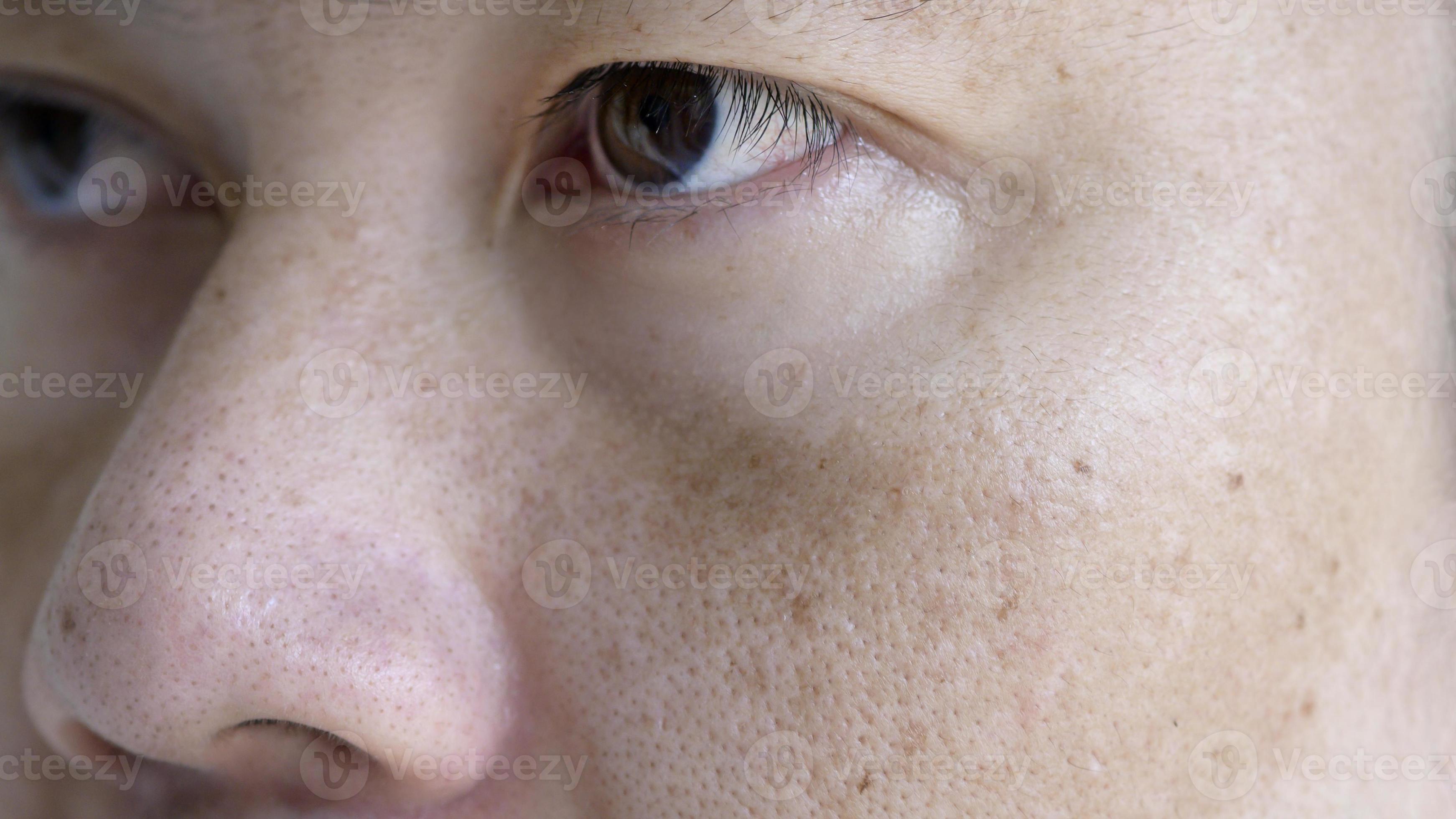 Close up Asian man face with freckles dark spots from uv light , skin