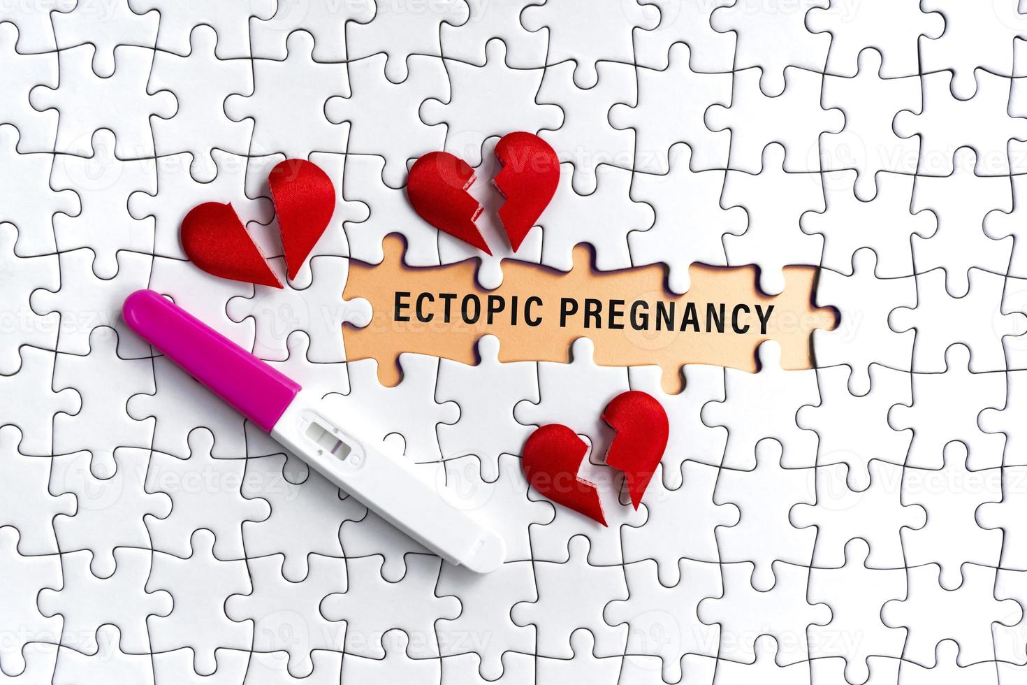 White jigsaw puzzle with ectopic pregnancy word over orange background. photo