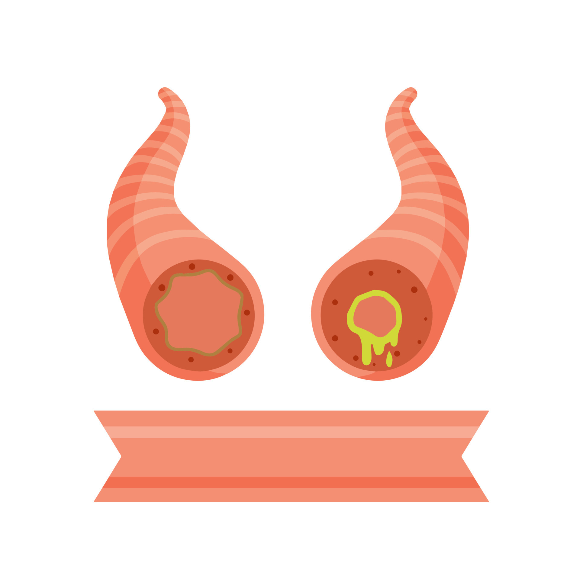 Asthma. The medical scheme. Respiratory tract disease. Damage to the