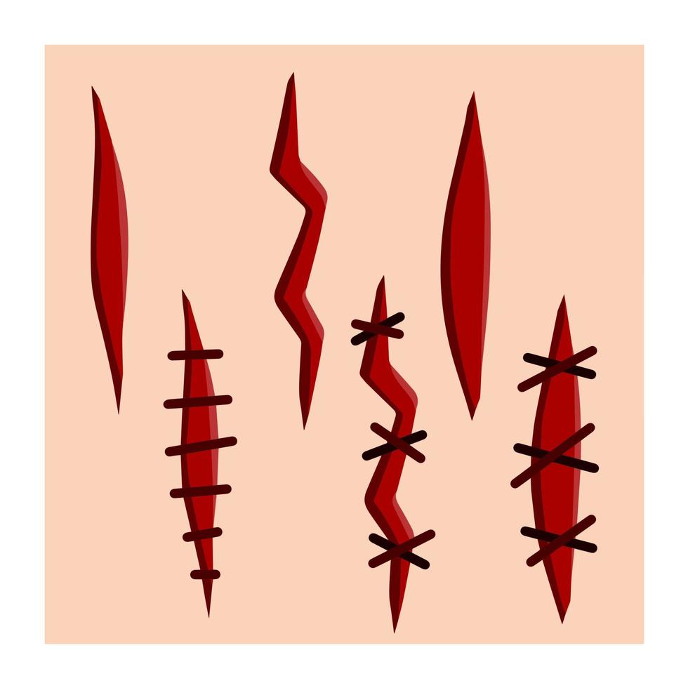 Bloody wound. Set of scratches. Stitches and medical care. Template for skin injury. A Bleeding Cut. Flat cartoon illustration vector