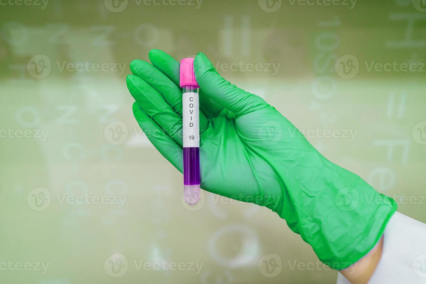 A rubber-gloved hand holds one test tube with coronavirus photo