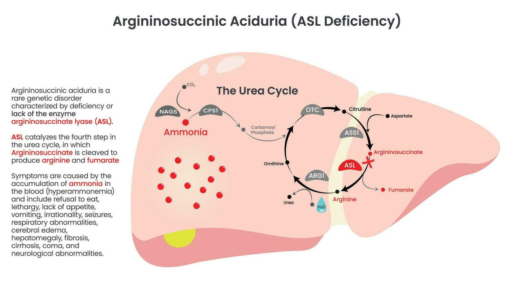 diagrama vectorial de deficiencia de aciduria argininosuccínico asl vector