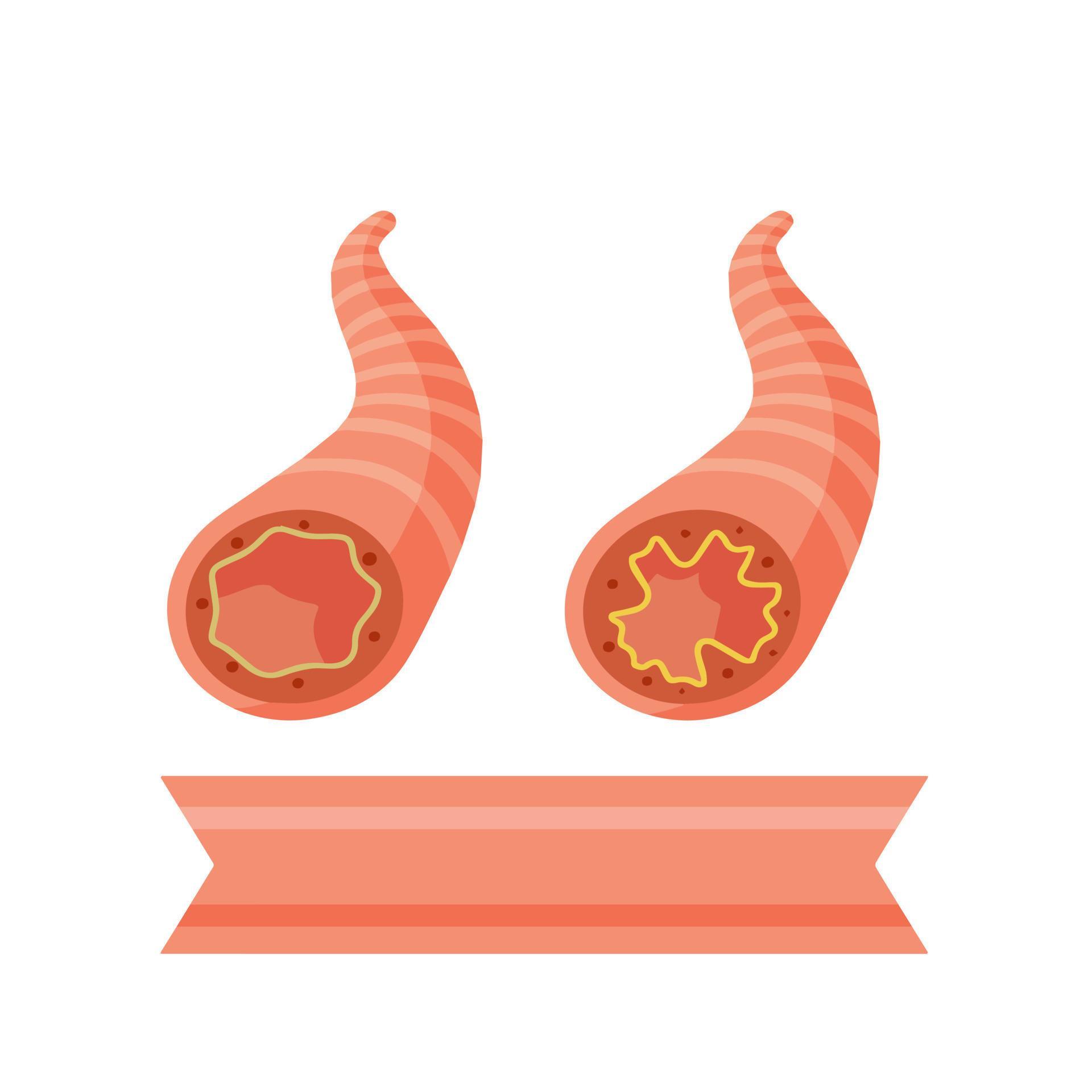 Asthma. The medical scheme. Respiratory tract disease. Damage to the