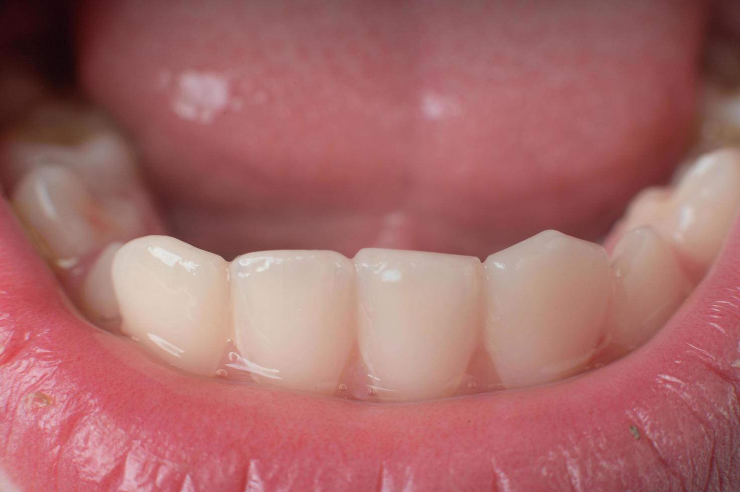 Jaw with children's straight teeth close-up. photo