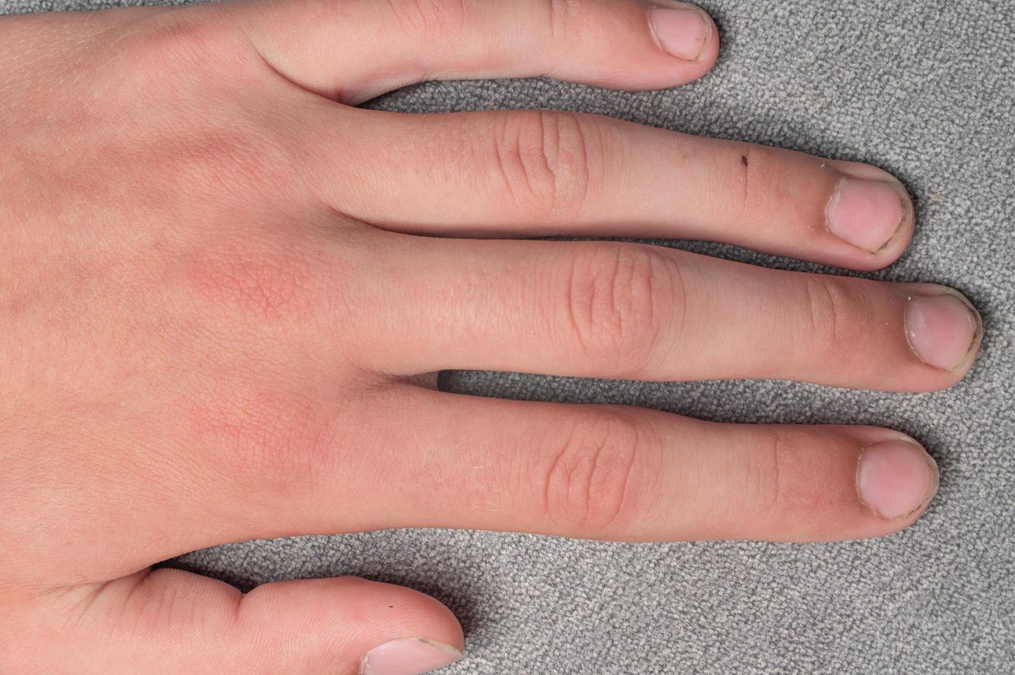 Dirty and long nails with burrs, fingers and fingernails of a child on a gray background. photo