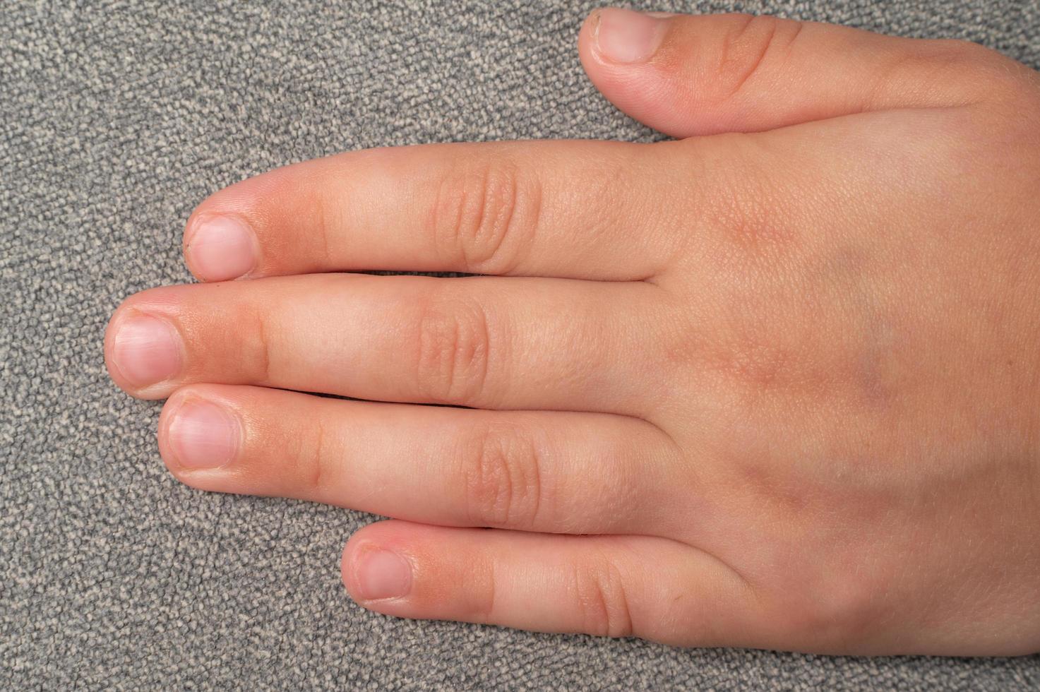 Child's dirty and sloppily cut nails, fingers and toenails close-up. photo