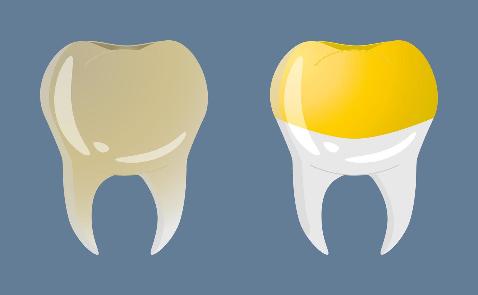 dientes en estilo realista. iconos de dientes amarillos. Ilustración de vector colorido aislado sobre fondo.