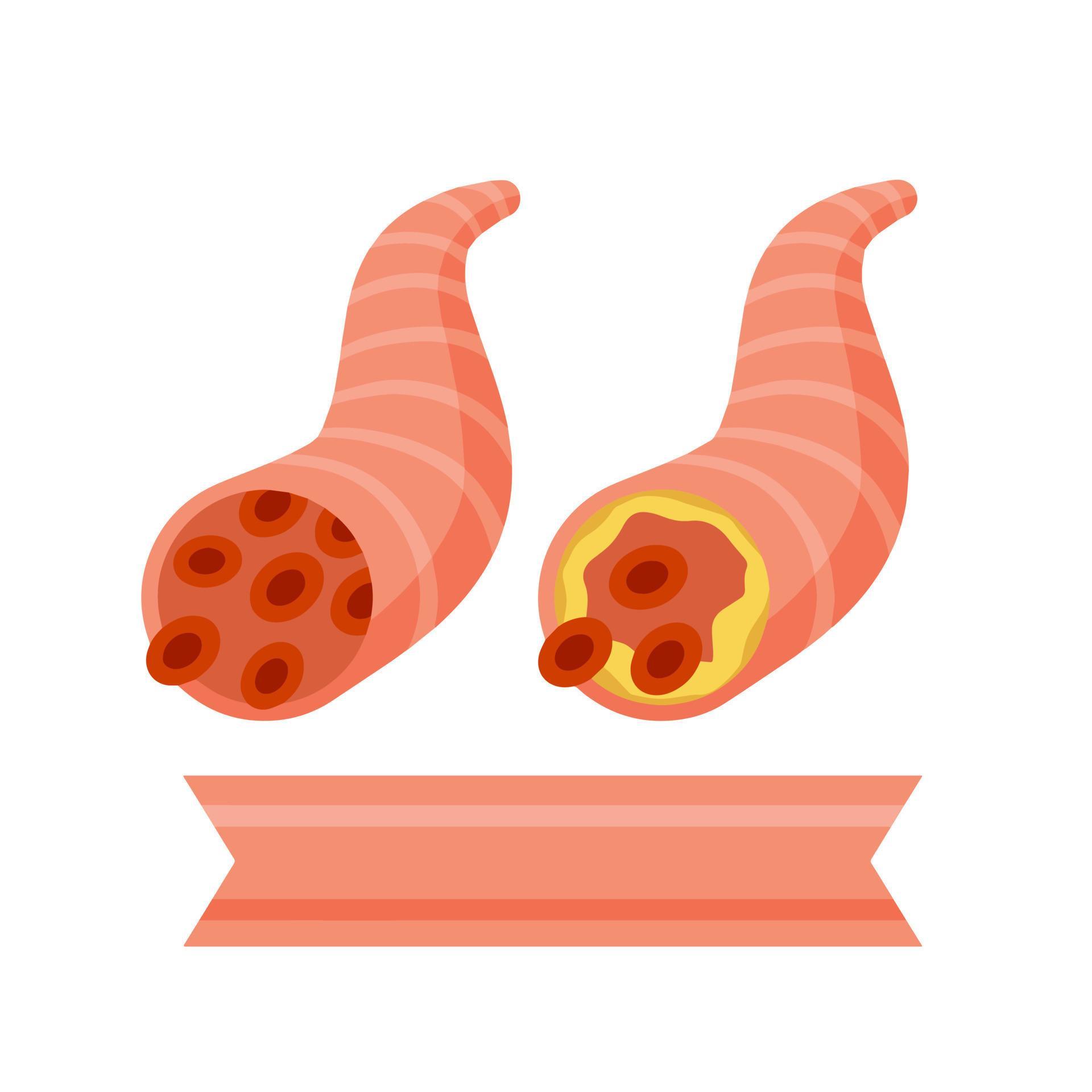 Asthma. The medical scheme. Respiratory tract disease. Damage to the