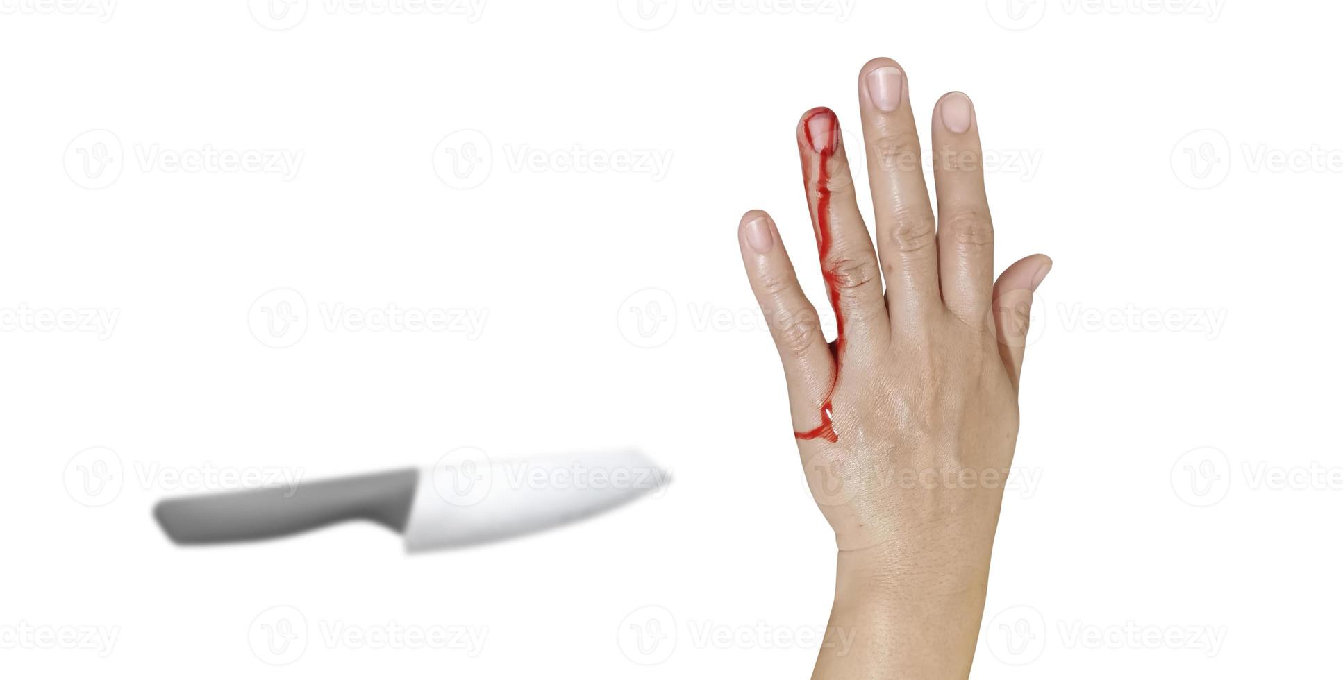 Bloody female hand and knife represents an injury accident on a white background photo