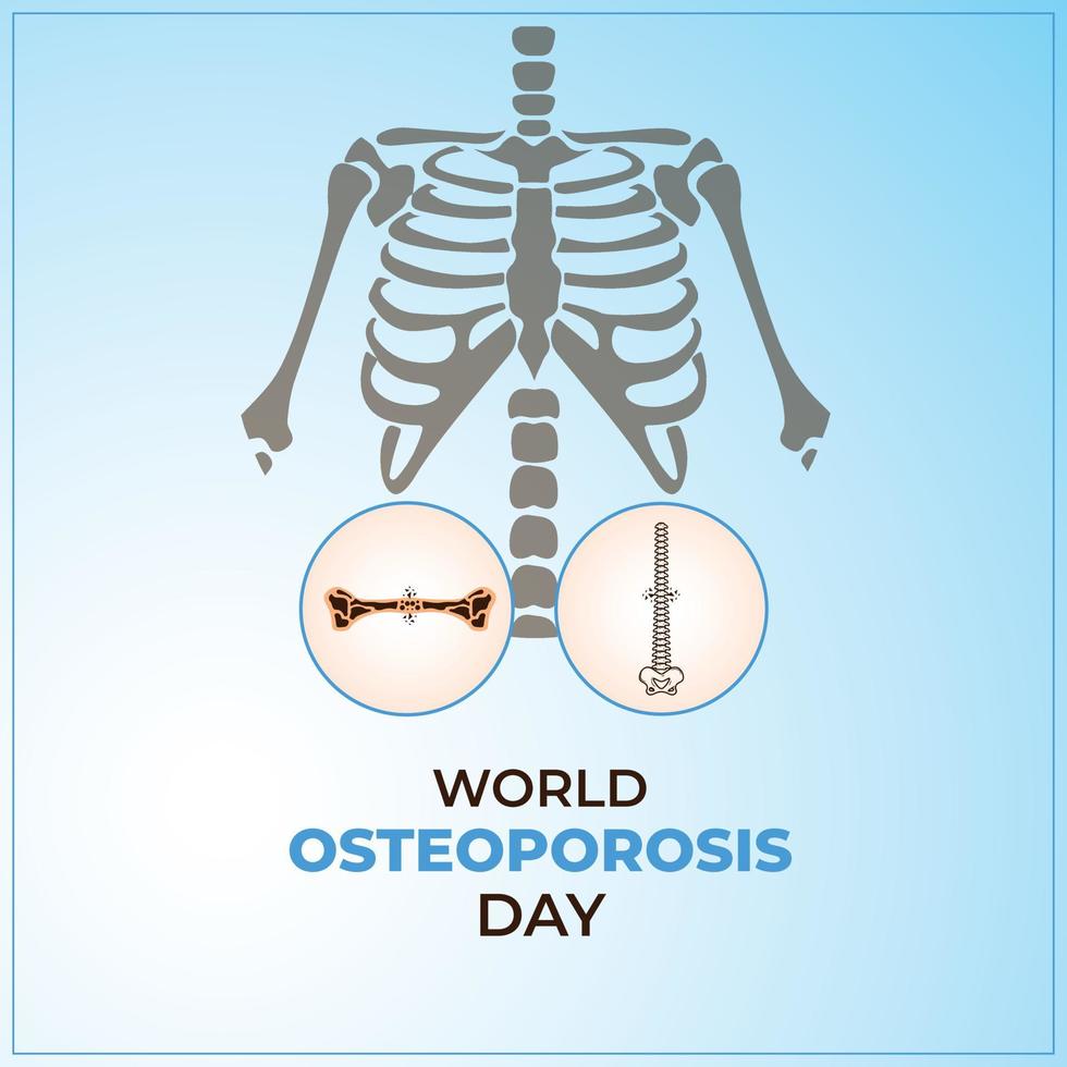 World Osteoporosis Day concept. October 20. Template for background, banner, card, poster. Vector illustration.
