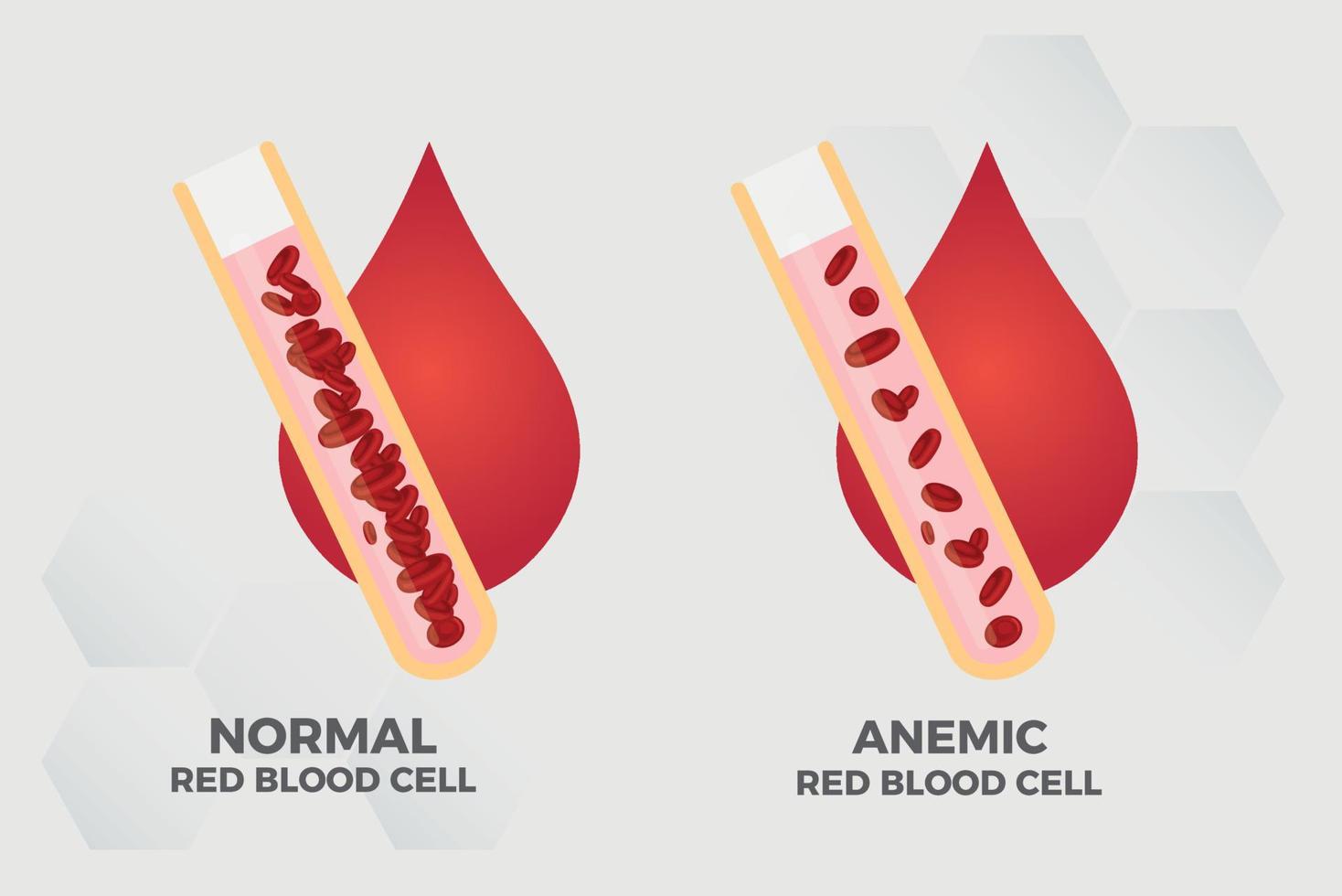 Anemia Iron red blood cell medical vector illustration medical.