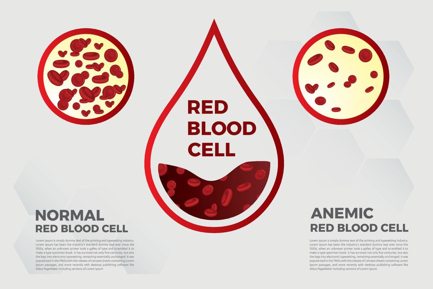 anemia hierro glóbulos rojos medical vector ilustración médica.