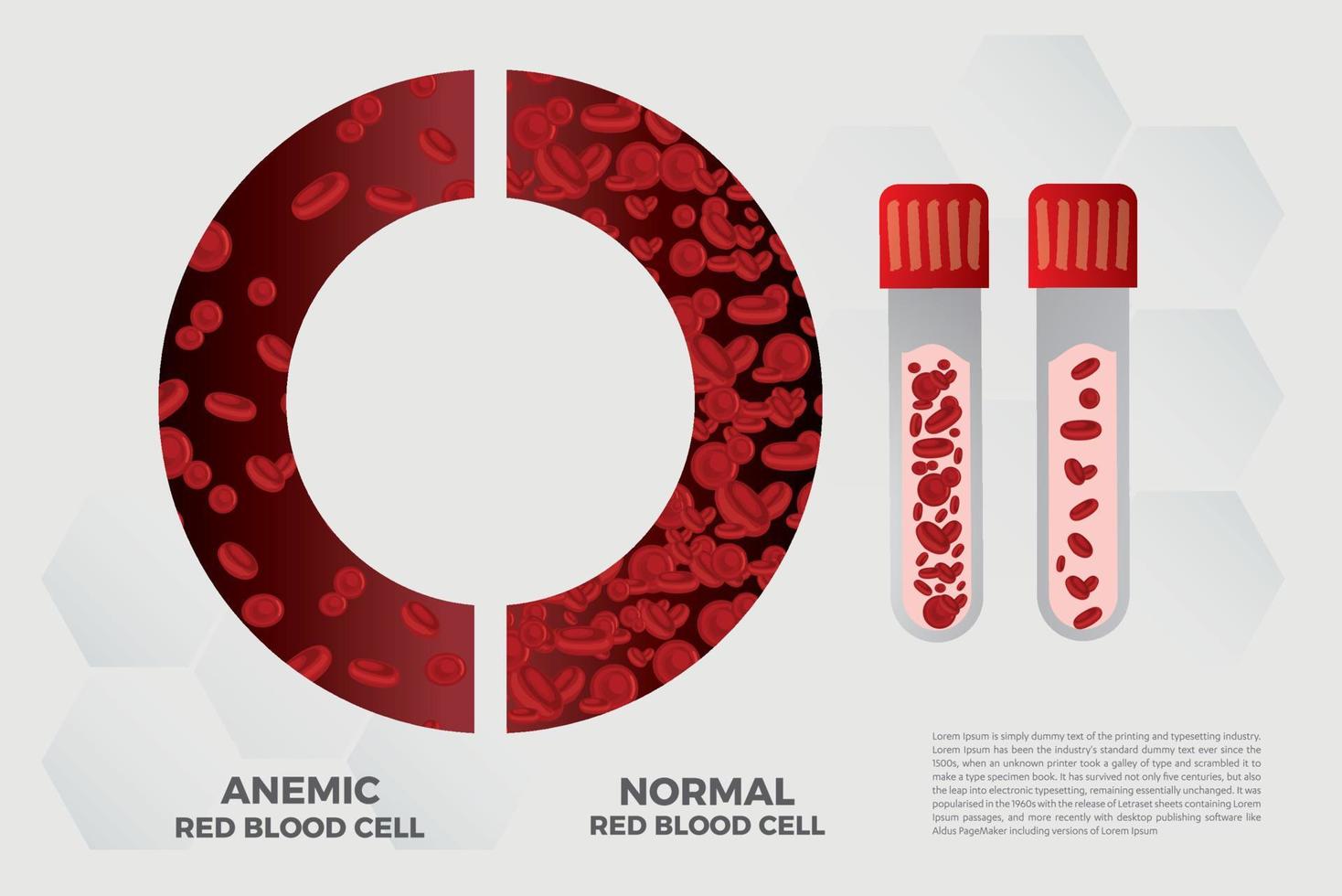 Anemia Iron red blood cell medical vector illustration medical.