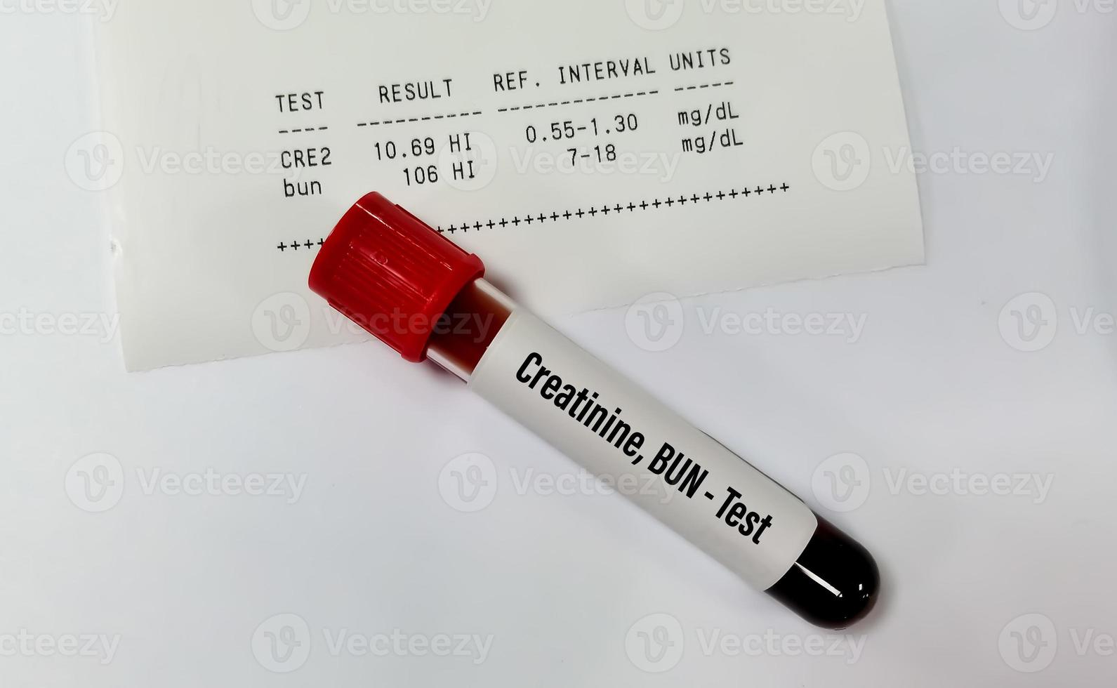 Blood sample tube isolated for Creatinine and BUN with abnormal report