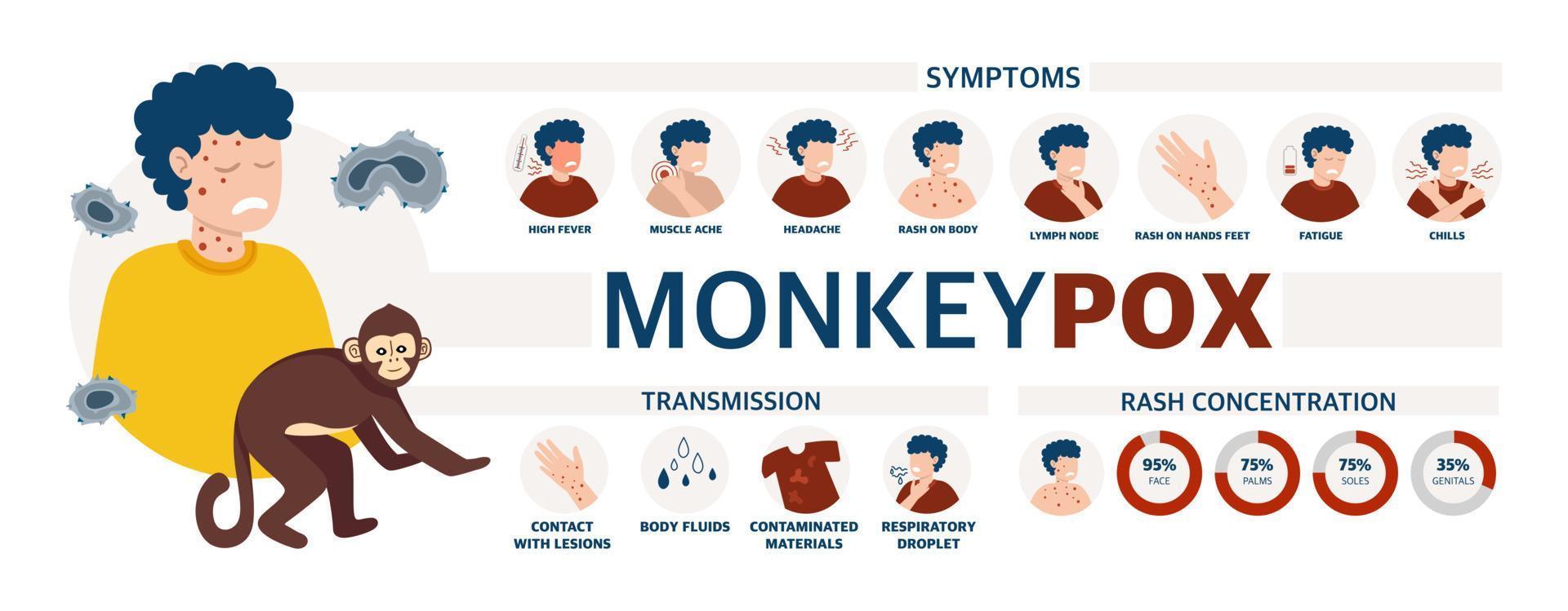 póster del virus de la viruela del mono para informar sobre la pandemia y la propagación de la enfermedad imágenes de métodos humanos de propagación y síntomas de la ilustración del vector de la enfermedad