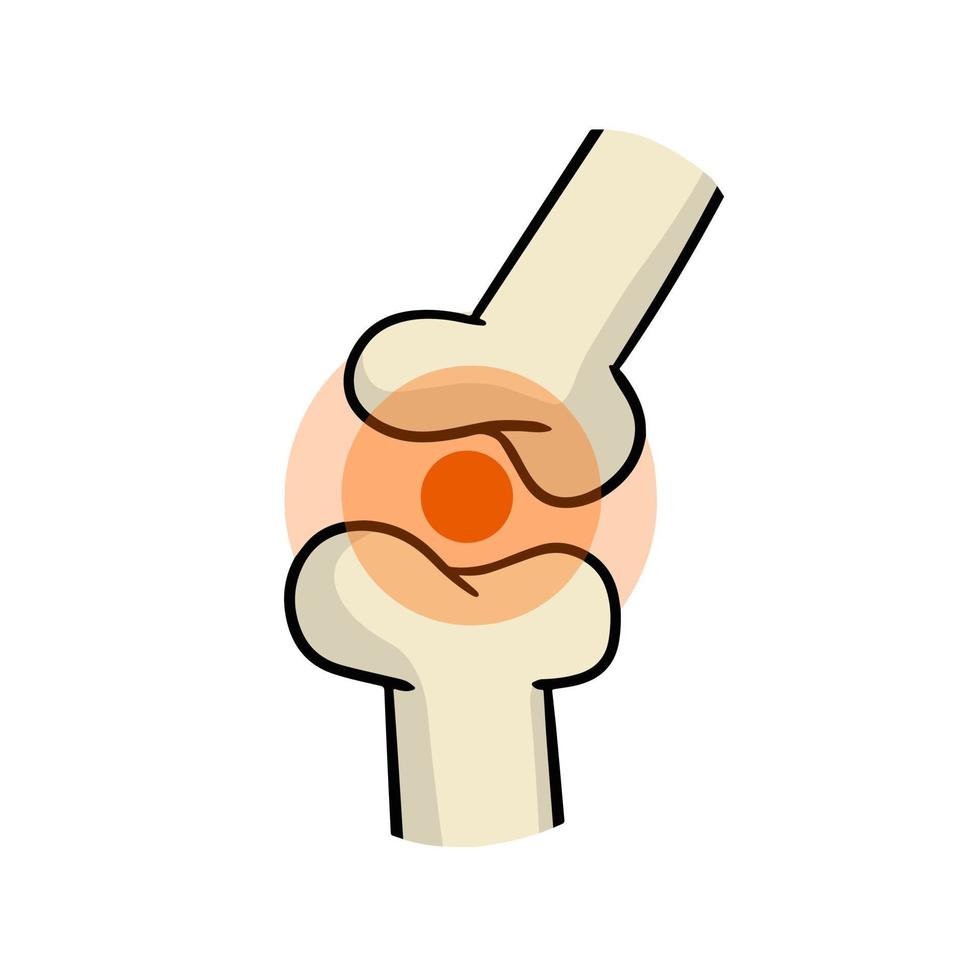 Arthritis. Disease of joints. Bones and interosseous cartilage. Biology and anatomy. Medical education and surgery. Red sore spot. Cartoon illustration vector