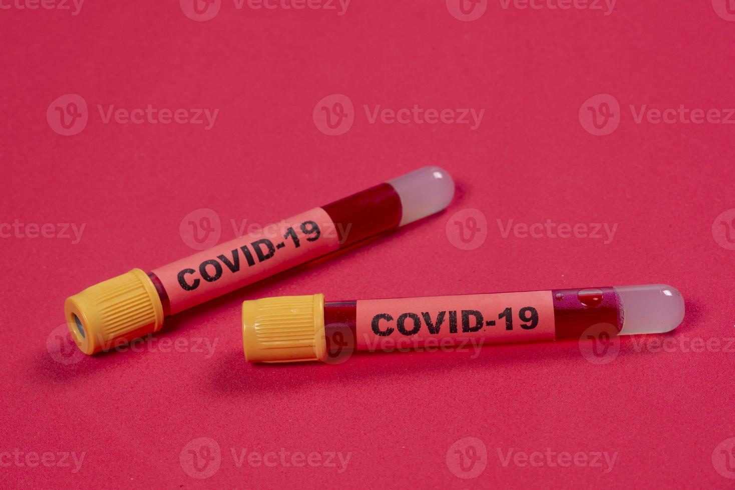 vacuum tube with blood and the word covid-19 on the identification tag. photo