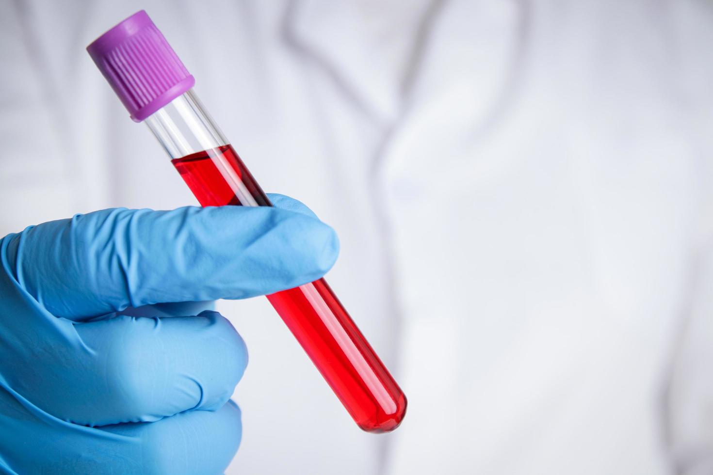 A scientist or researcher in a laboratory holds a test tube to invent a vaccine against the coronavirus. Concept of treatment Medical experiments prevent the spread of the covid-19. photo