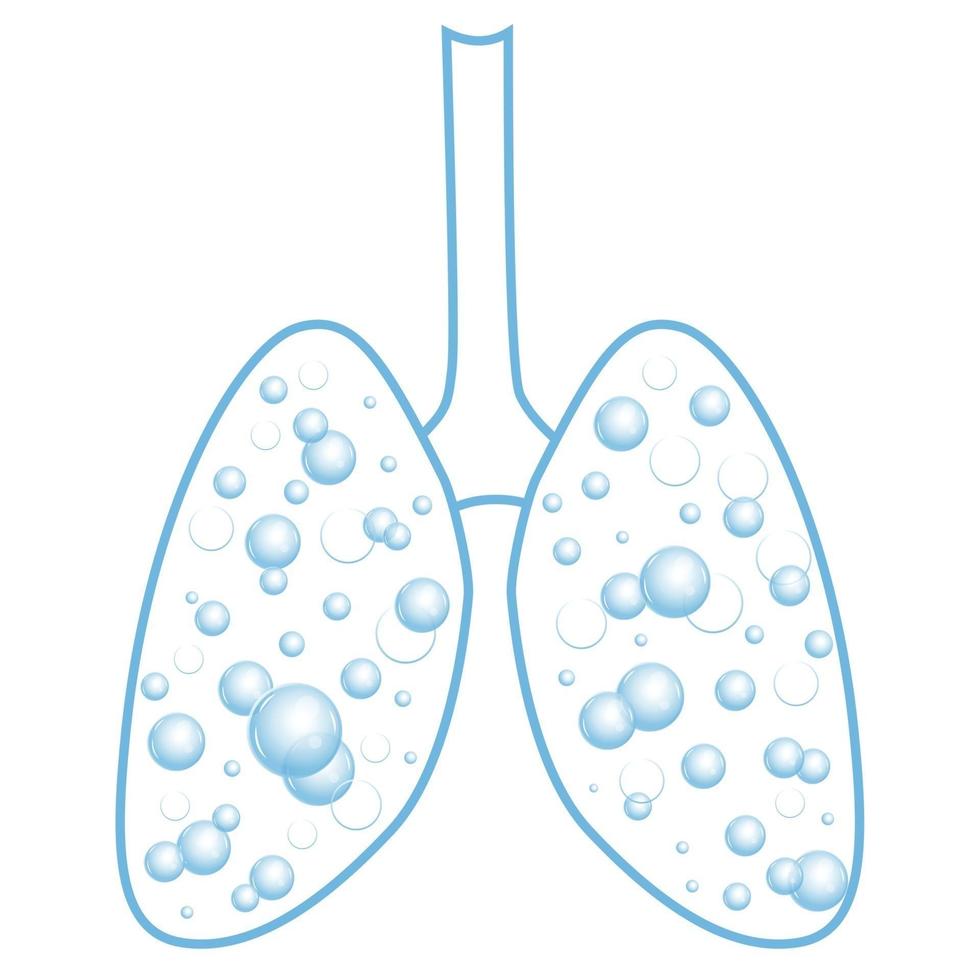 Pulmonary edema. Fluid in the respiratory organs. Bubbles in the lungs. Vector illustration.