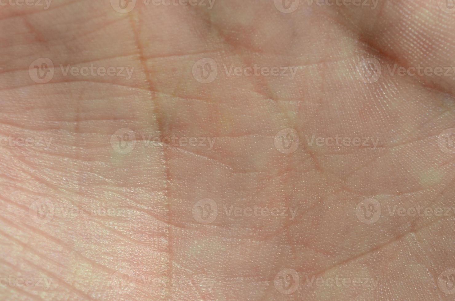 Close up of human hand skin with visible skin texture and lines photo