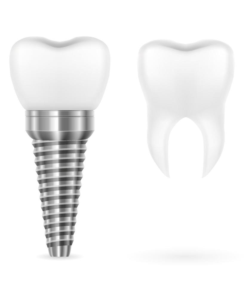 metal human tooth implant vector illustration isolated on white background