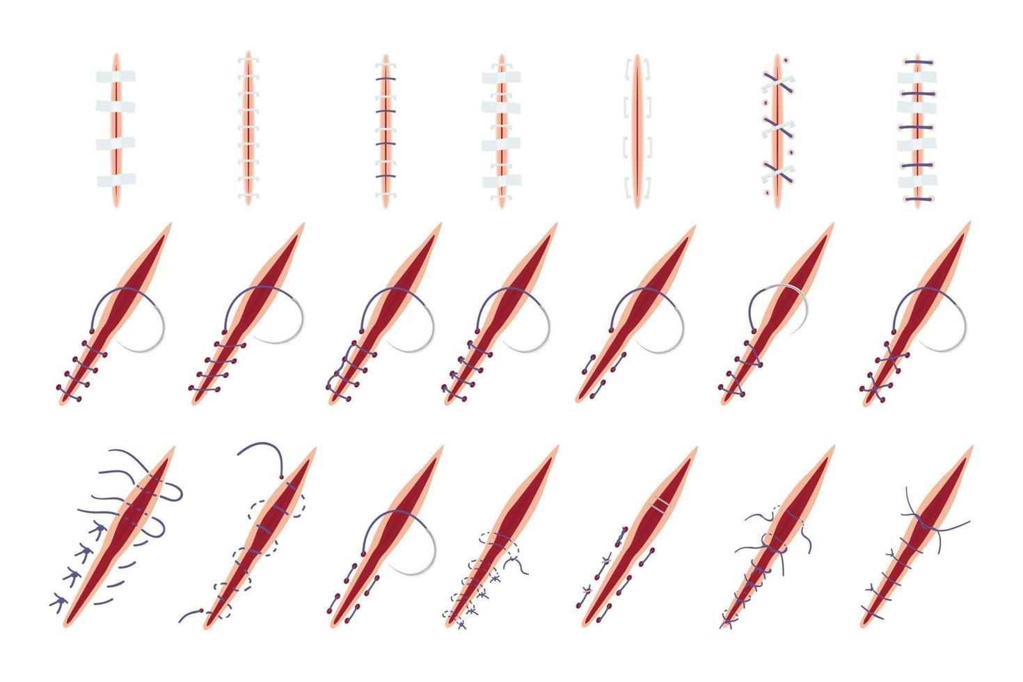 Suture icons set cartoon vector. Wound surgical vector