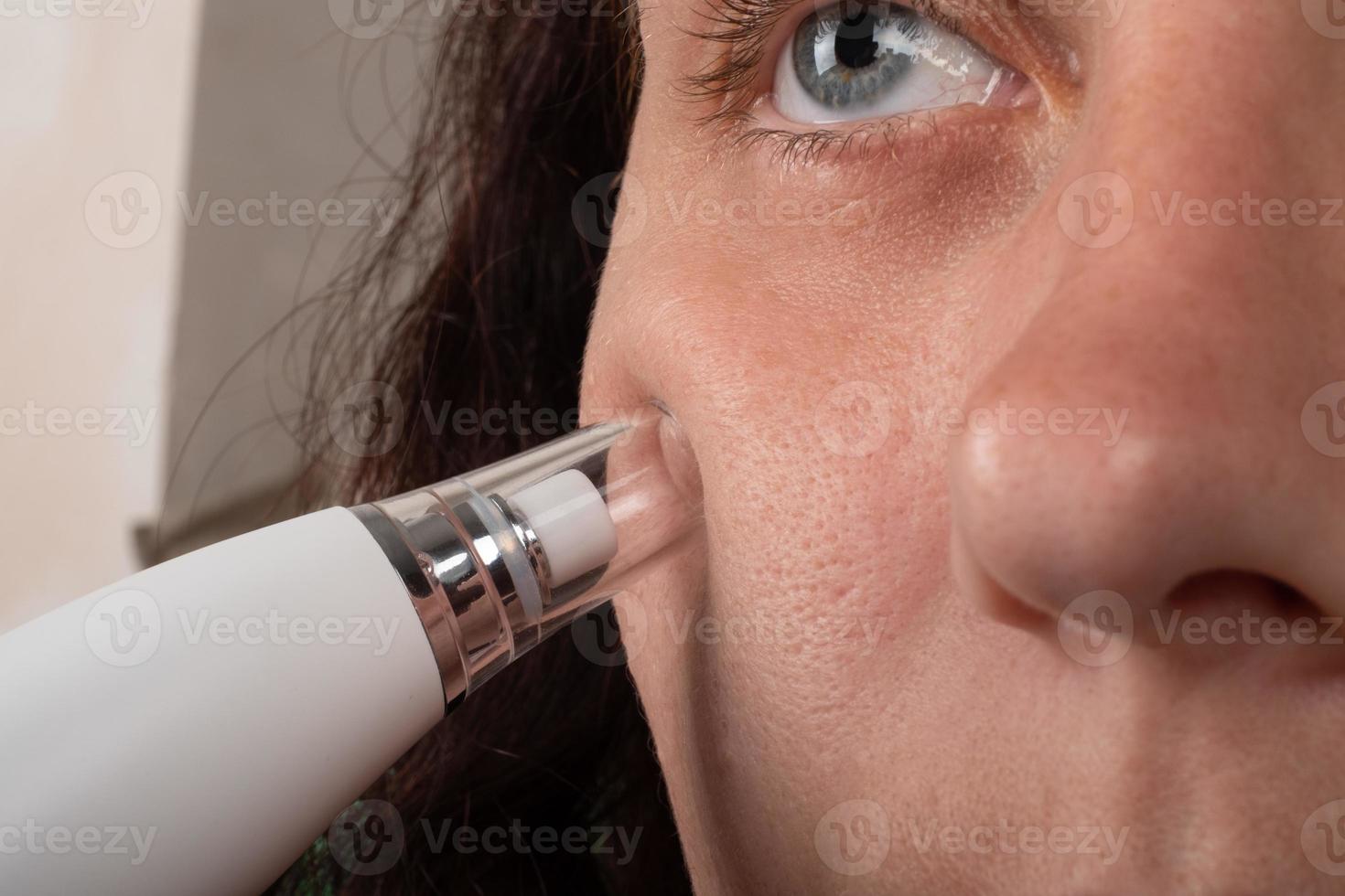 woman with vacuum face pore cleaner, skin care photo