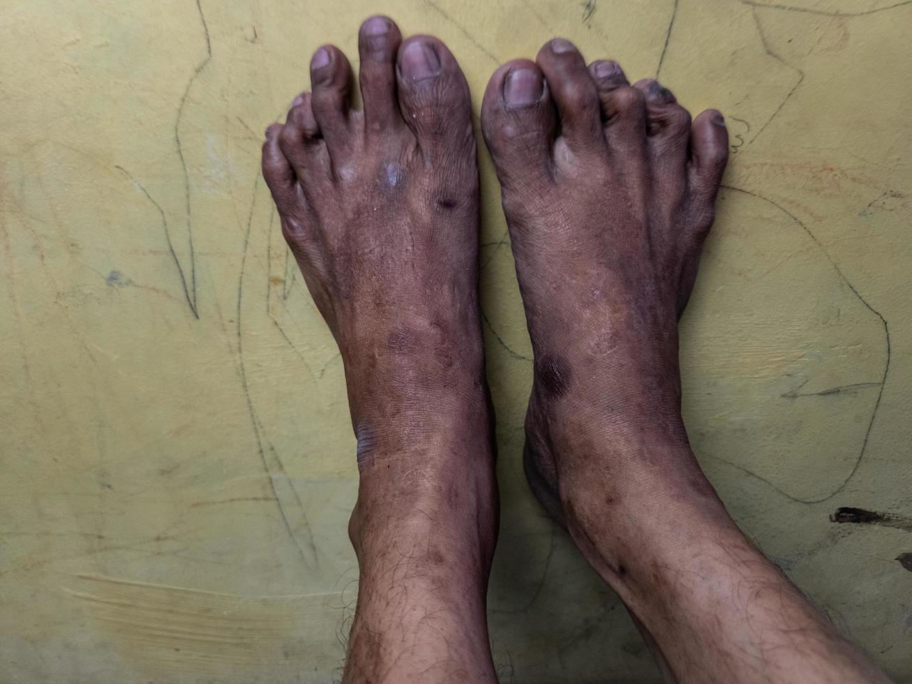 Foot photo, taken with a detailed position with a natural skin tone texture photo