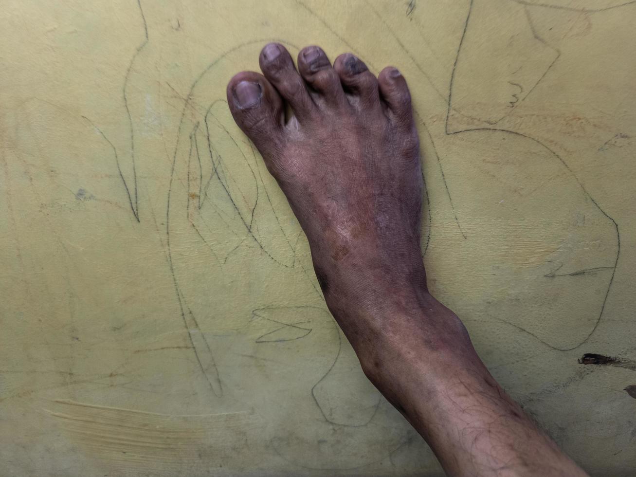 Foot photo, taken with a detailed position with a natural skin tone texture photo