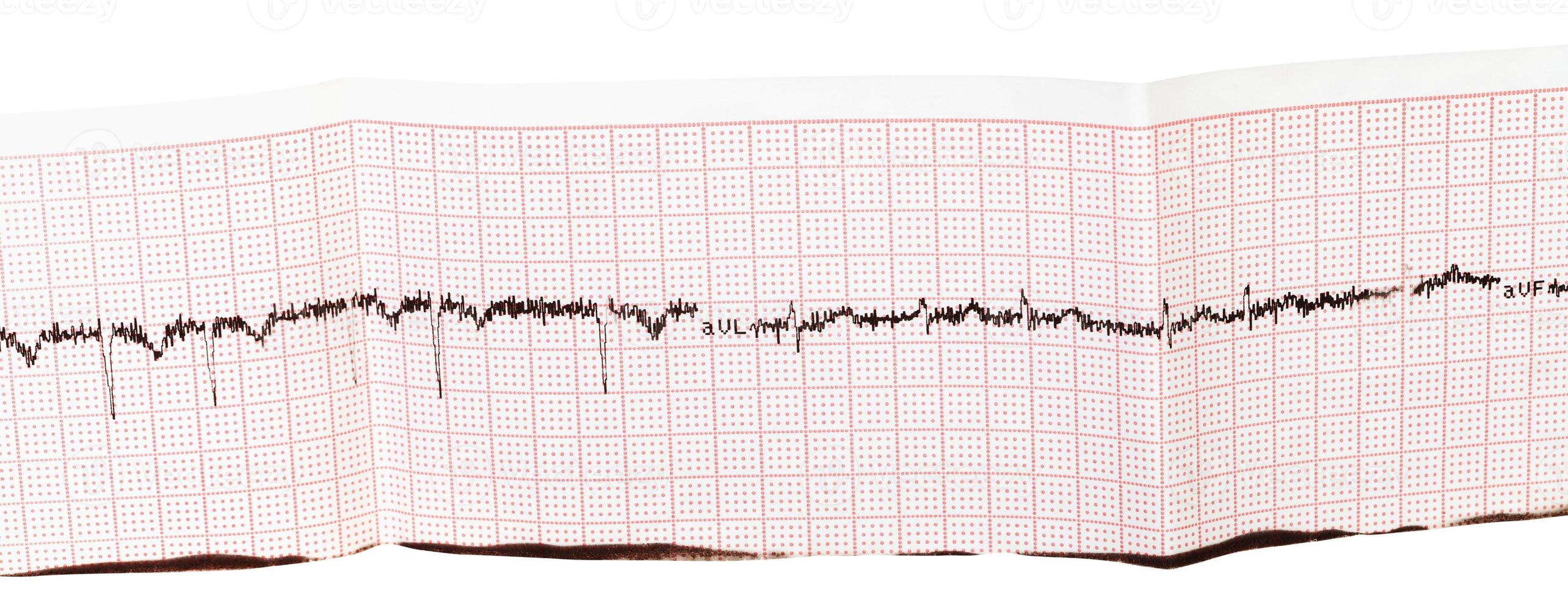 electrocardiogram ECG, EKG on paper photo