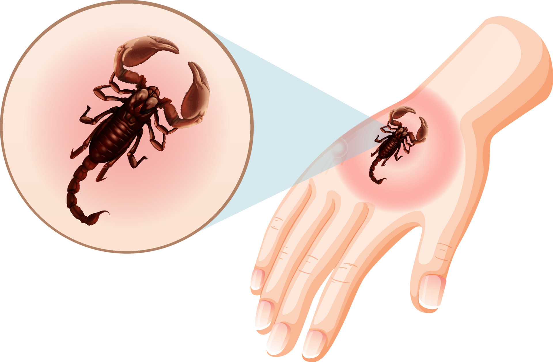 scorpion-bites-sting-on-skin-12495697-vector-art-at-vecteezy