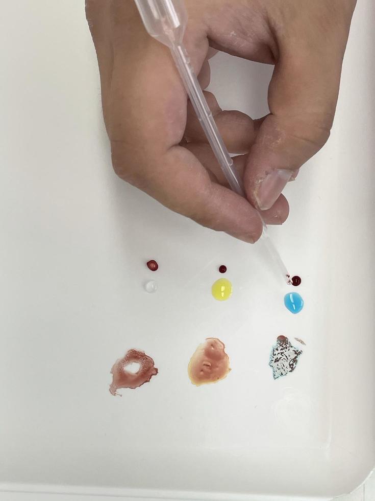Blood test view photo