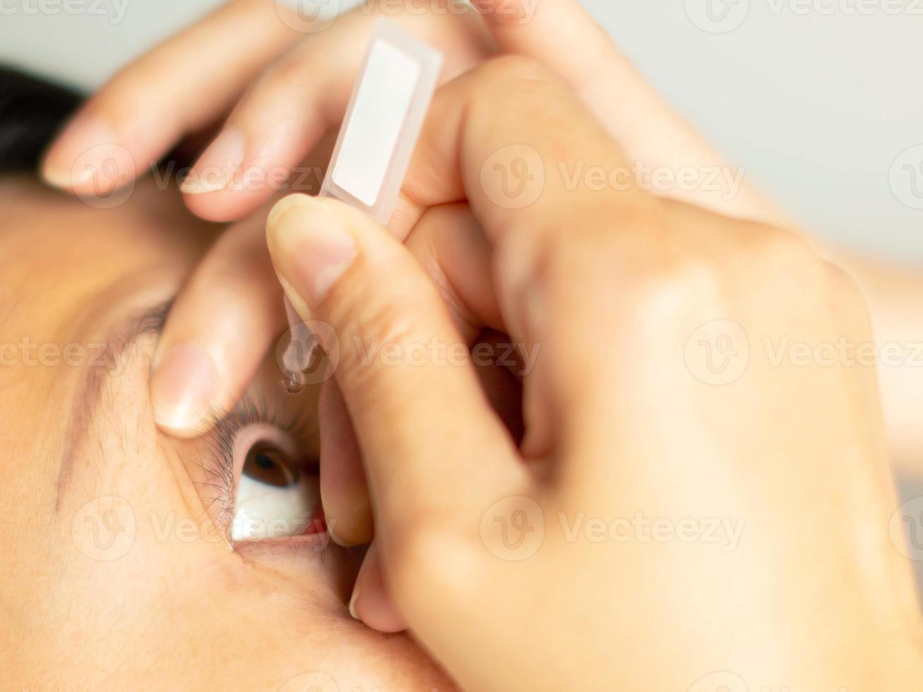 una imagen de cerca de una mujer está usando una gota de lágrima artificial en un ojo para agregar humedad, enfoque selectivo en la gota de lágrima artificial y el ojo. foto