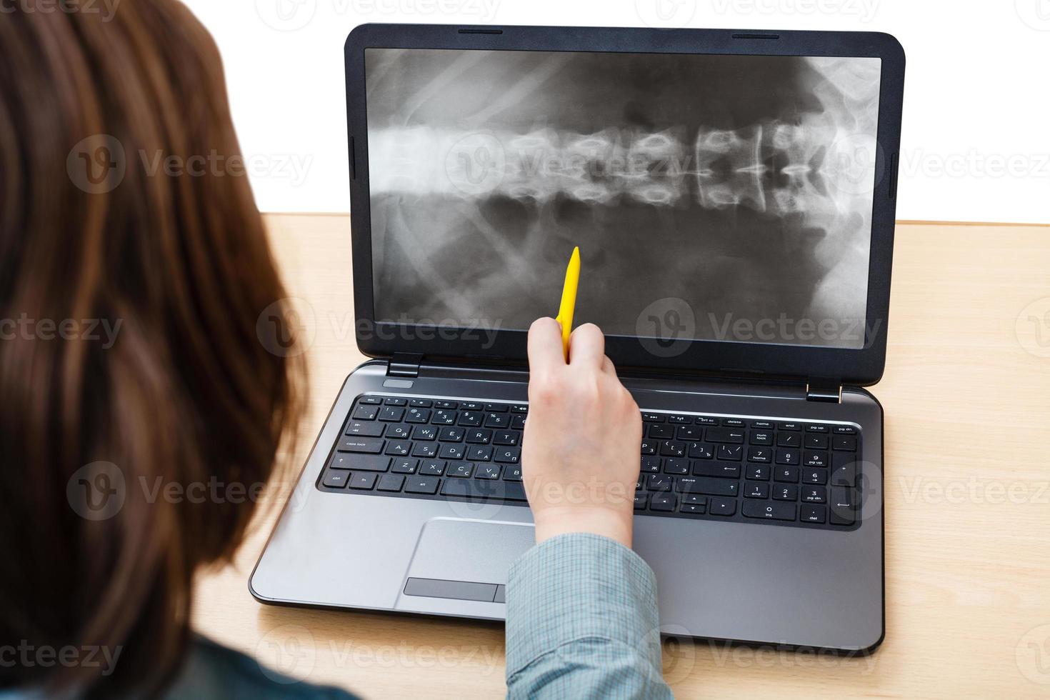 el estudiante analiza la imagen de rayos X de la columna vertebral en la computadora portátil foto