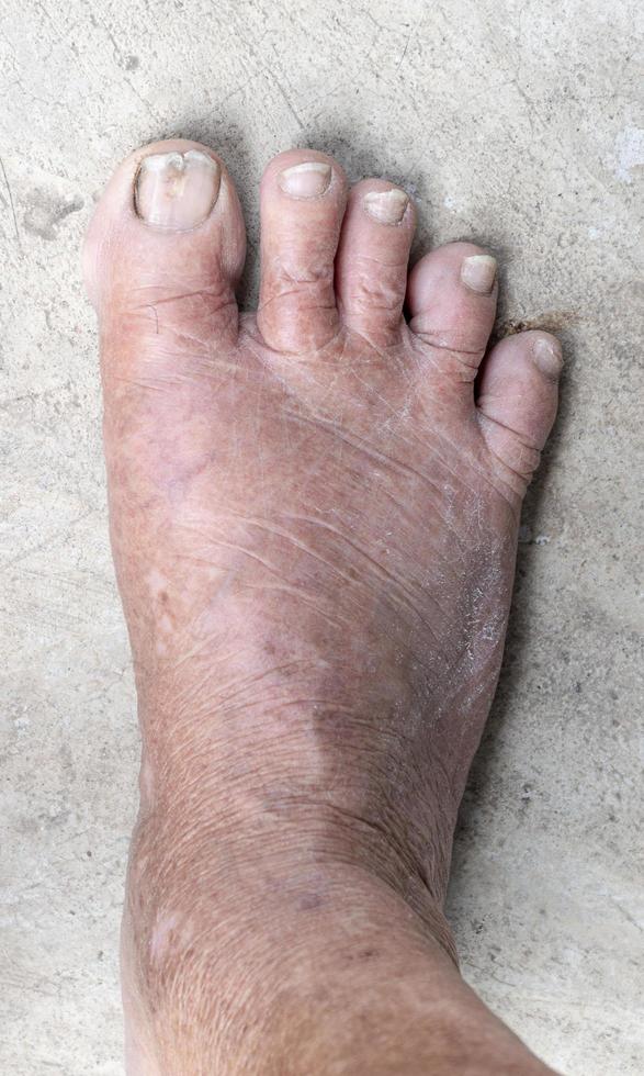 Top down view right foot of elderly woman photo