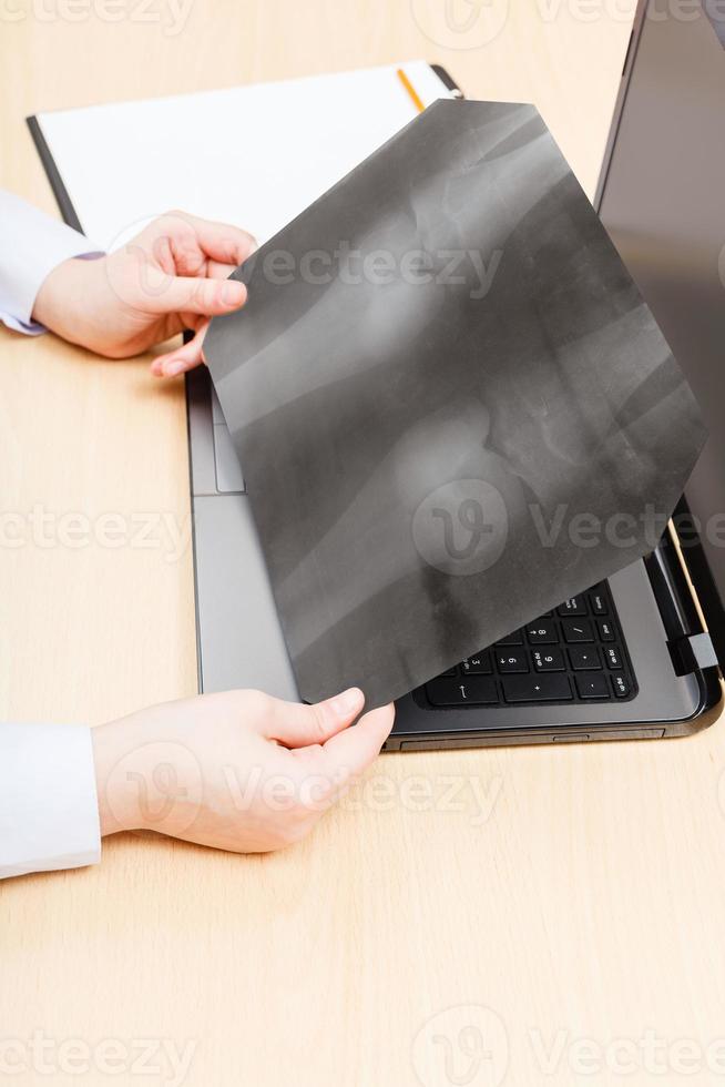 doctor examines X-ray picture of knee joint photo