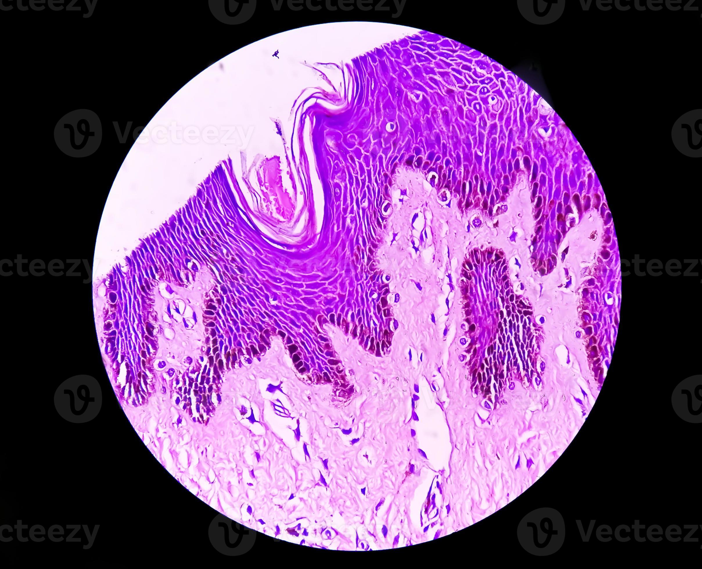 Could That Scrotal Mole Be Cancer?  Find Out Now - 3d2nzip