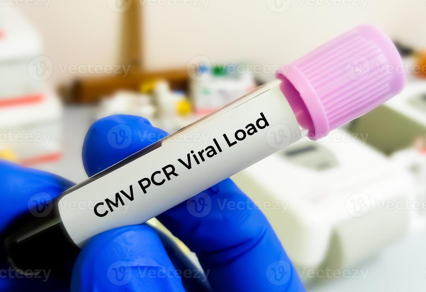 Cytomegalovirus or CMV PCR viral load for DNA Detection and Quantification photo