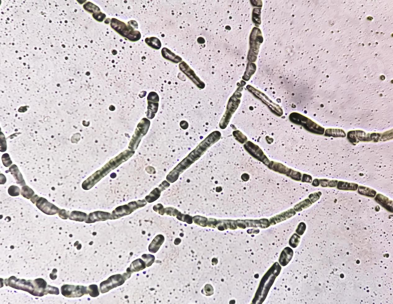 Photomicrograph showing Hyphae of dermatophytes, Nail scraping for fungus test photo