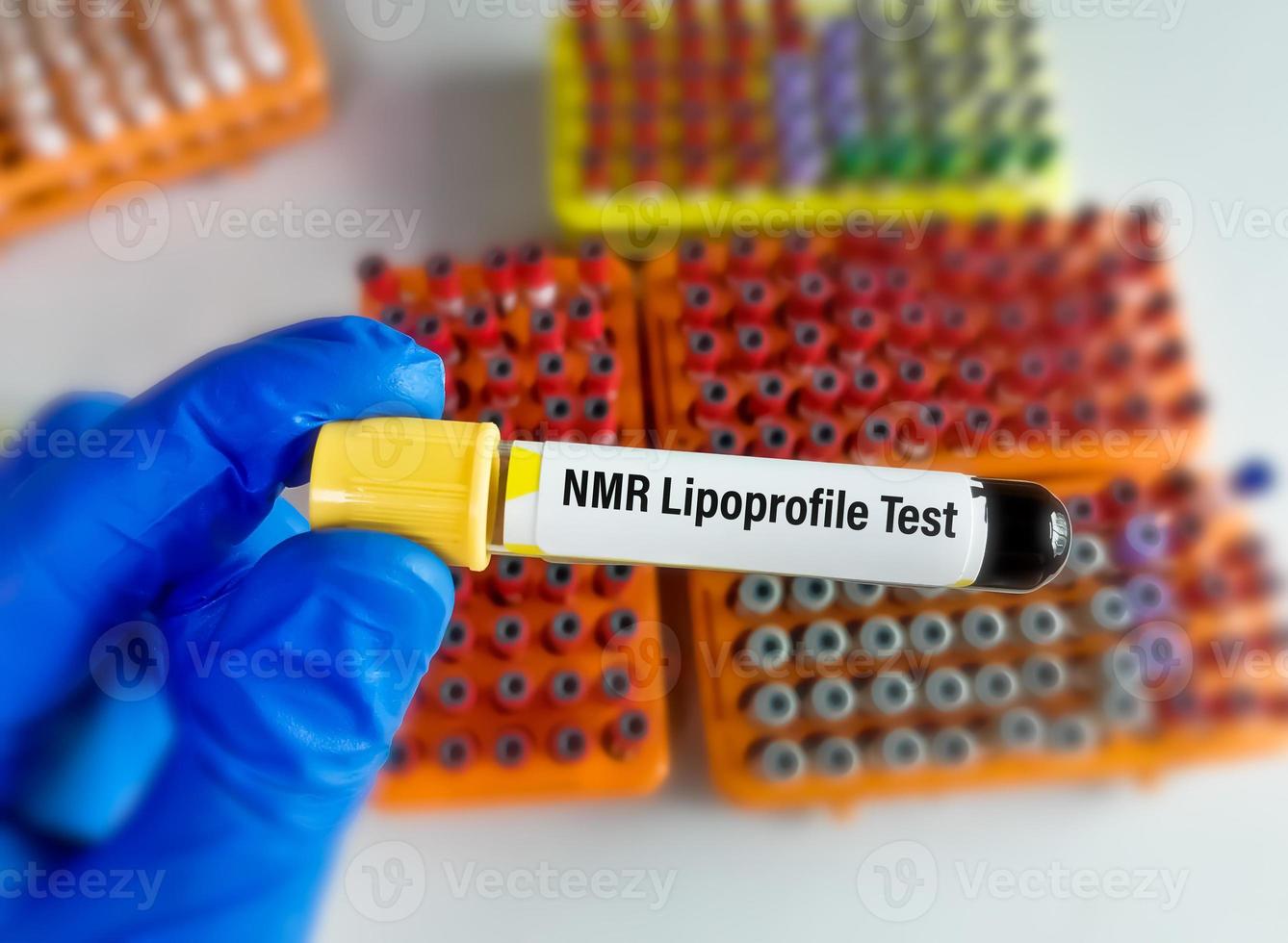 Blood sample for NMR Lipoprofile test. 12601166 Stock Photo at Vecteezy