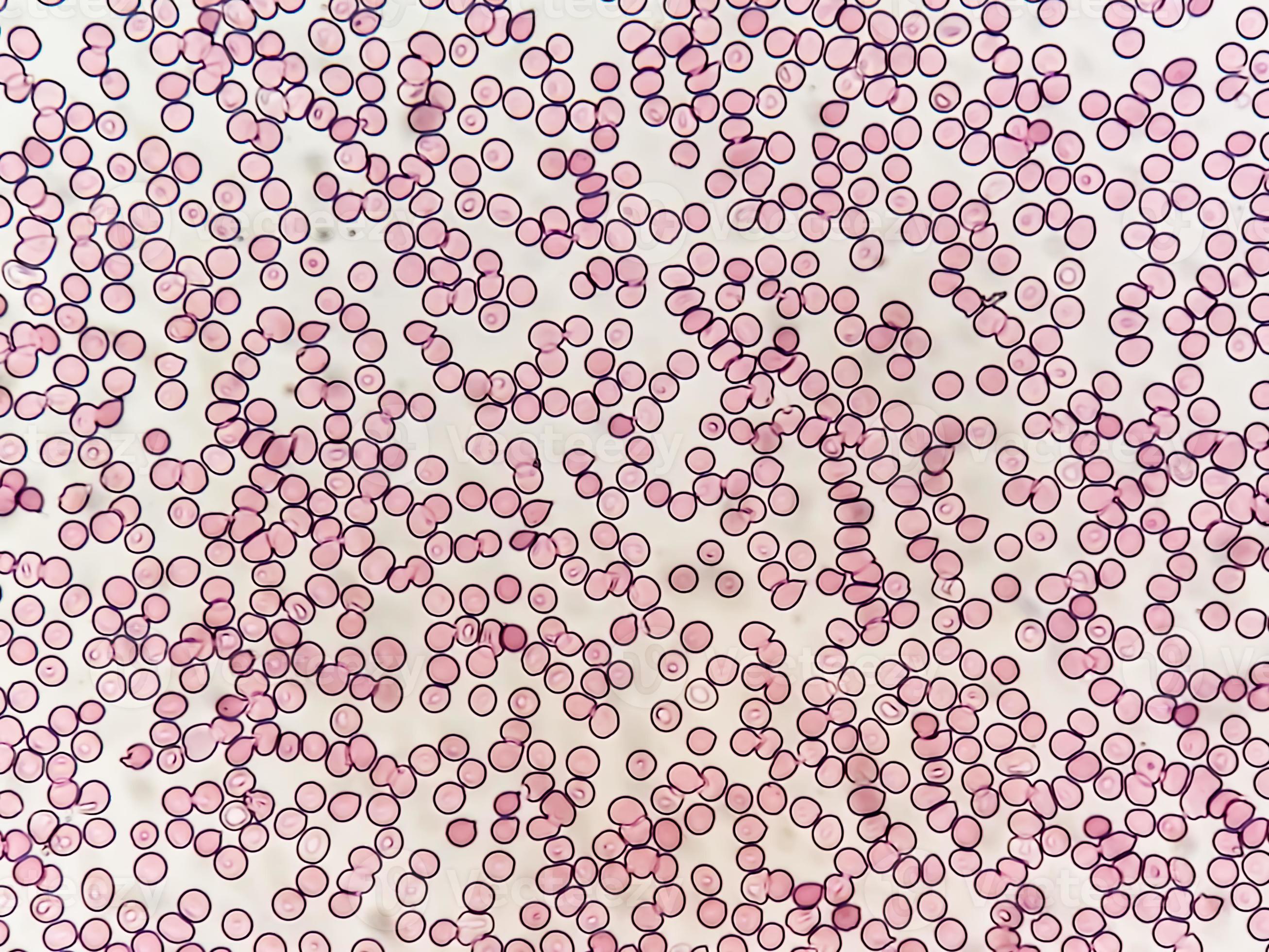 Platelets under microscope