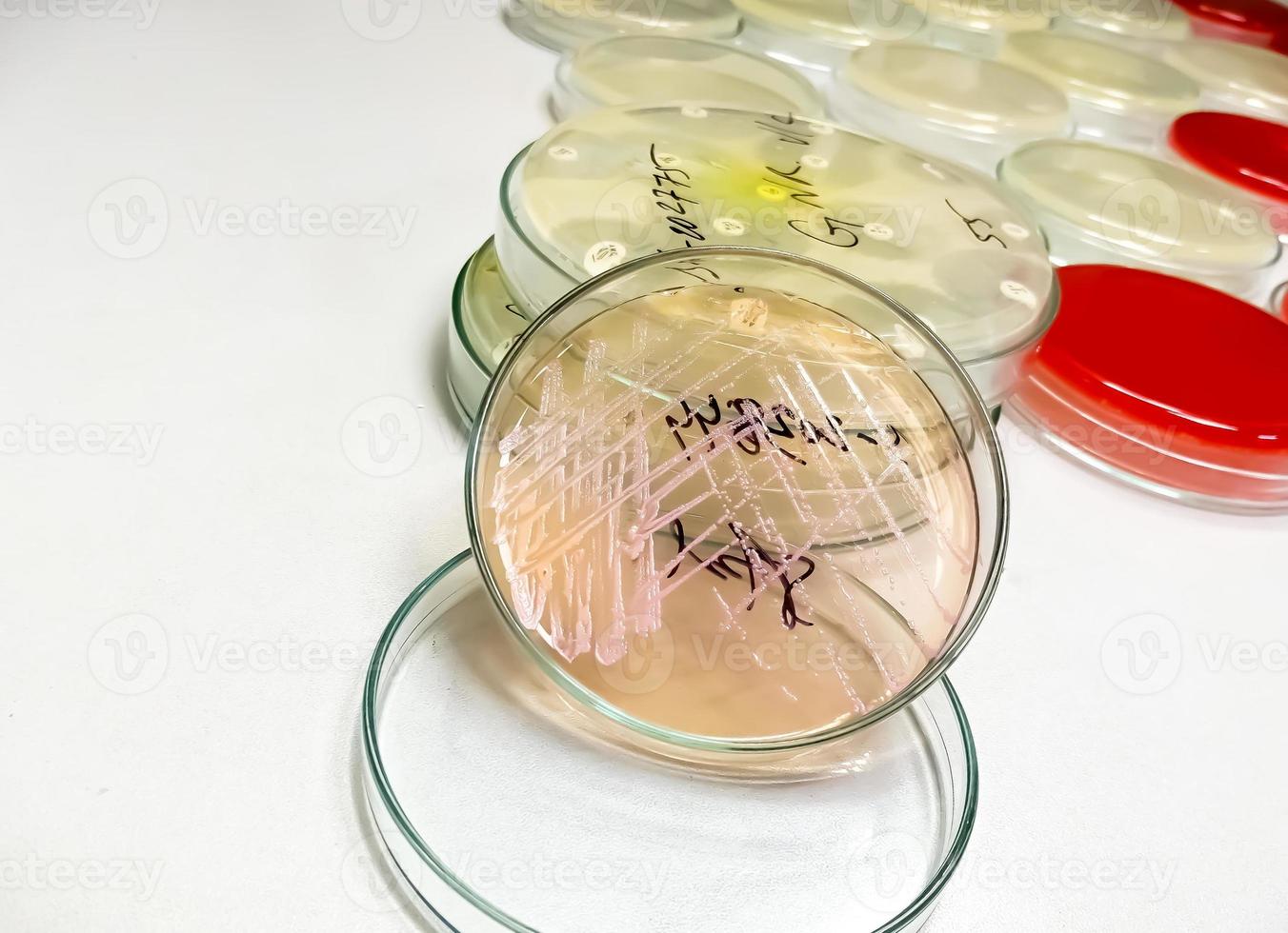 placa de petri con colonia bacteriana aislada en el fondo de un laboratorio de microbiología. medios de cultivo bacterianos. microbiólogo. bacterias foto