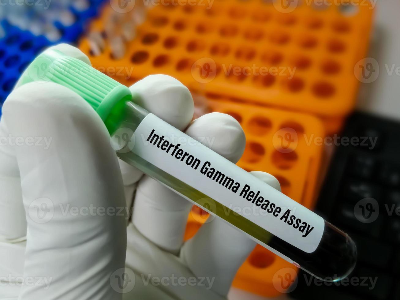 Blood sample for Interferon Gamma Release Assay or IGRA test for diagnosis of Tuberculosis photo