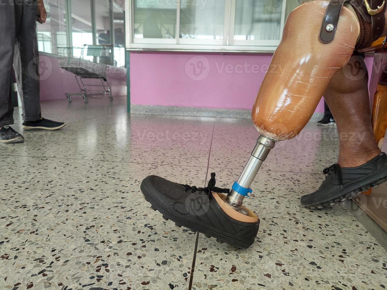 BK disability using and training leg prothesis photo